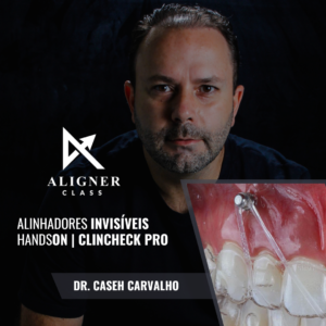 Imersão Aligner Class - Dr. Caseh (Em Breve)