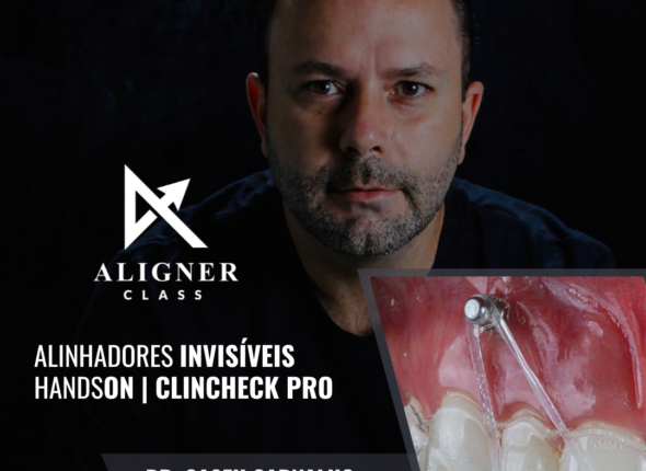 FEED ALIGNER CLASS (1)